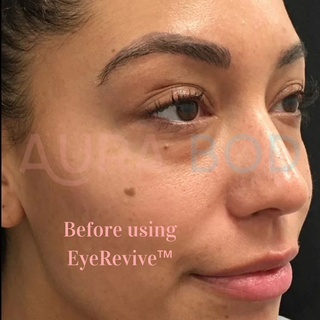 EyeRevive™ Eye Massager