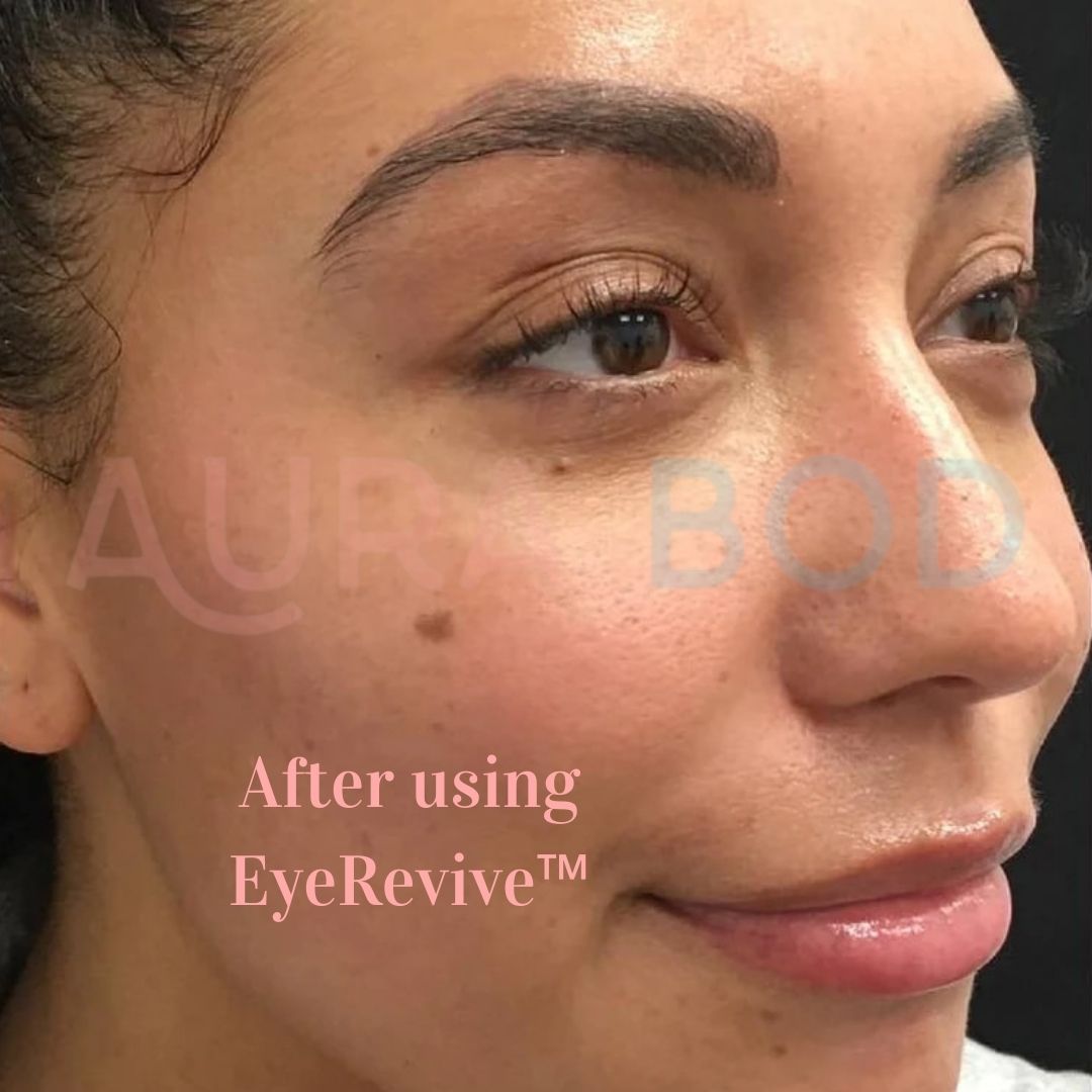EyeRevive™ Eye Massager
